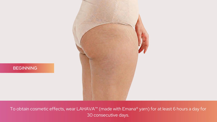 Before using Lahava shapewear made with Emana yarn showing thigh skin texture